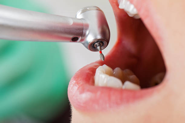 Professional Emergency Dentist in MI